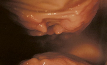 My g-spot (descending bulge) was sliced from back to front and twice more (not visible here) from side to side.