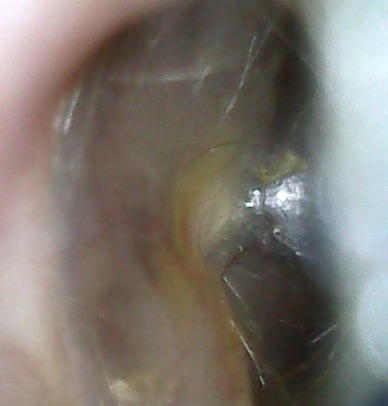 wH1EQ1xPT92C1zYWQM%vDw_thumb_1723