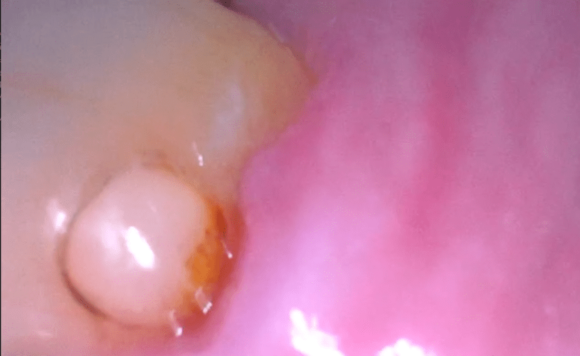 3 dots white flare 2019-05-11 at 11.34.44 AM.png