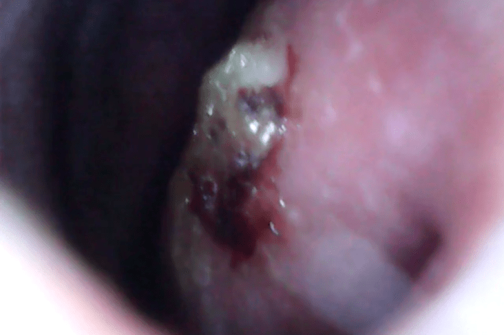 Nose button 4 2019-04-15 at 12.04.12 AM.png