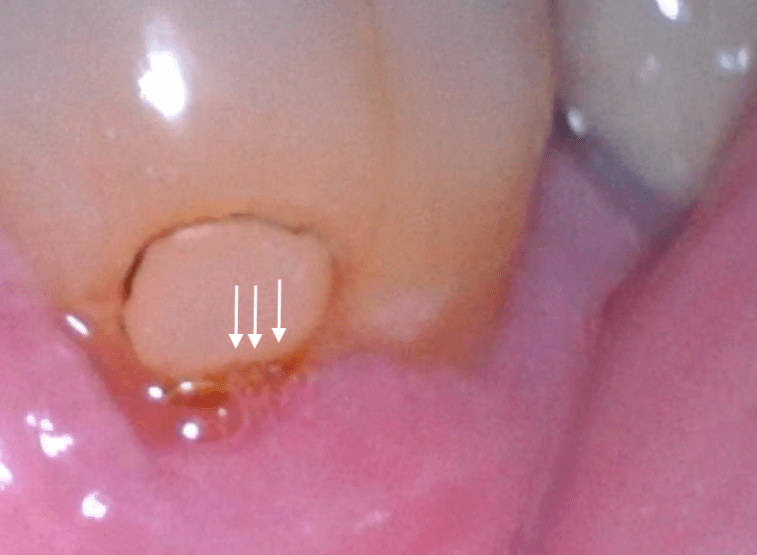 three dots n sm bubbles w arrows 2019-05-11 at 6.02.55 AM crop.png