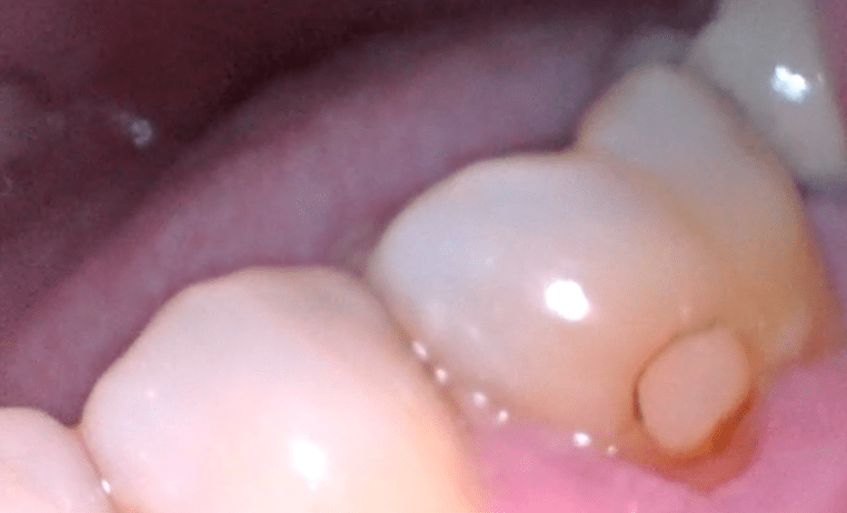 white flare 2019-05-11 at 11.32.56 AM.png