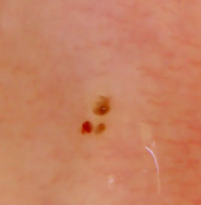 punctures 3 2019-08-12 at 4.09.36 PM sm.png