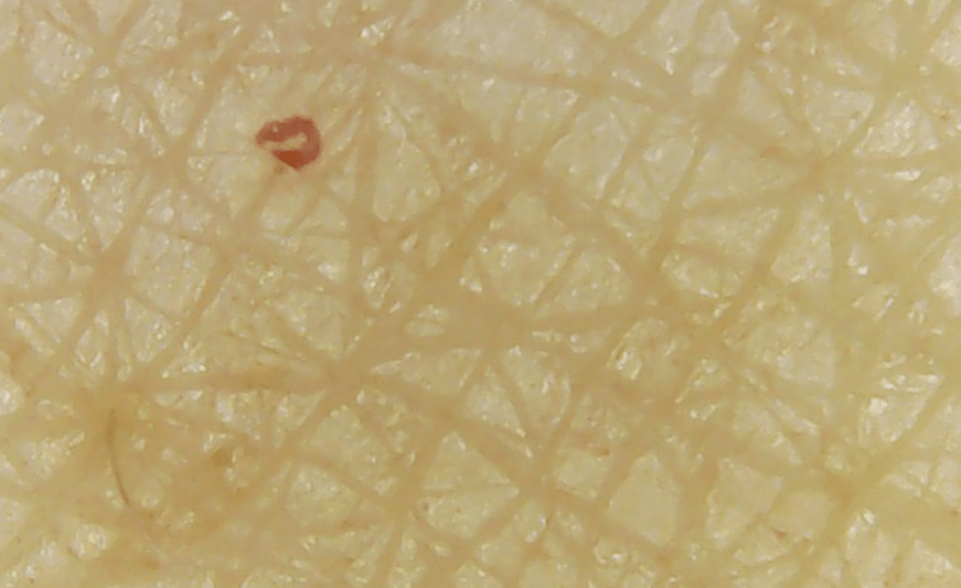 Star pattern w red spot 2019-08-06 at 8.04.22 AM.png