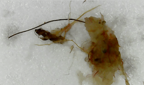 Fiber clump 2019-10-11 at 6.07.21 AM.png