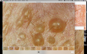 Spirochete maybe 2020-02-26 at 2.17.38 PM copy.png